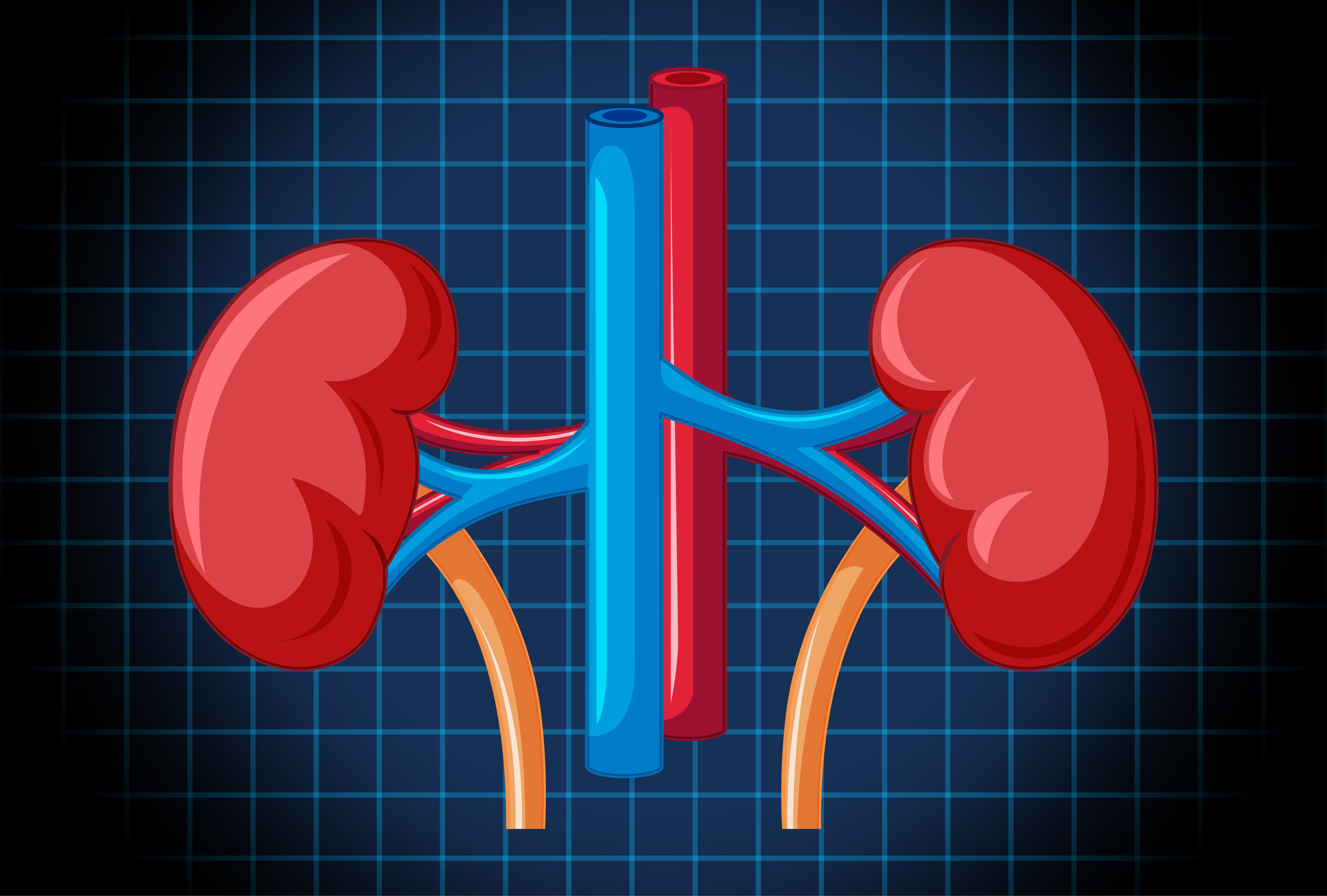 Kidney Failure