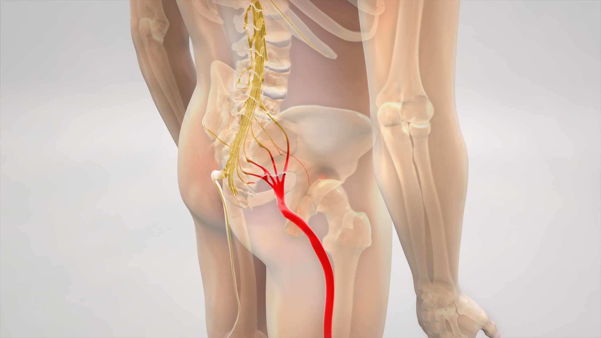 Sciatica Treatment